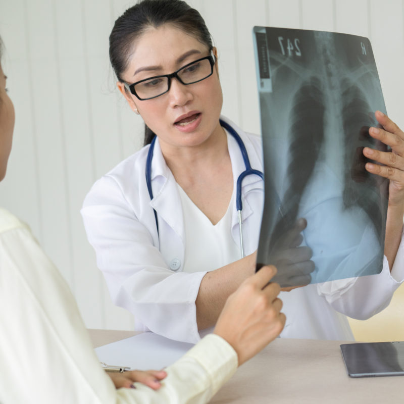 Female doctor holds x-ray